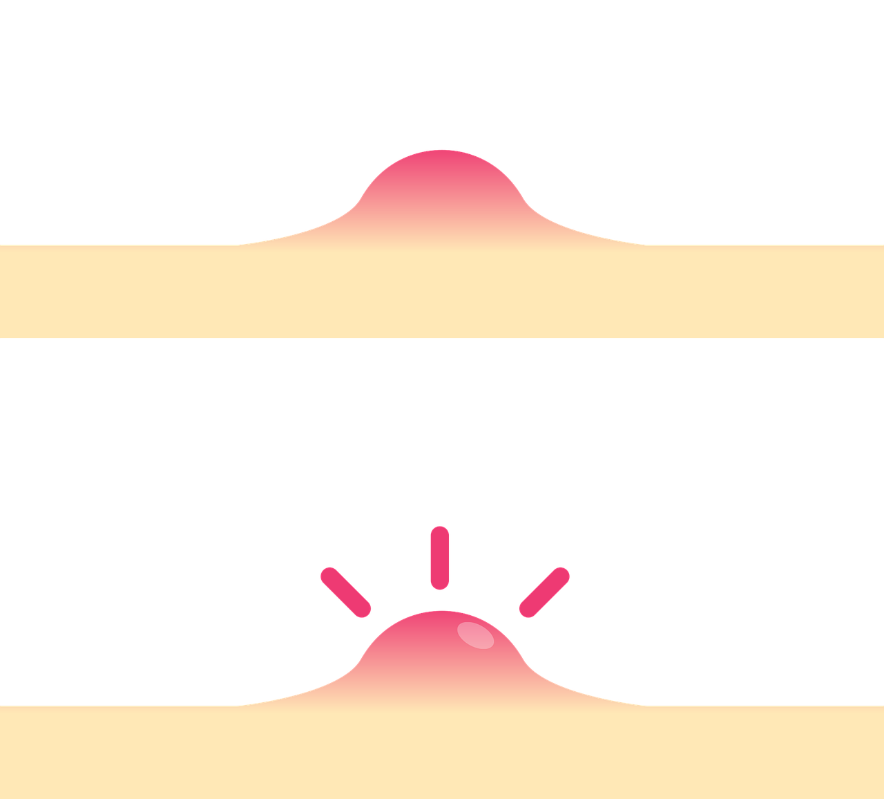 haut, ärger, gesicht, medizinische, akne, haut, haut, akne, akne, akne, akne, akne
