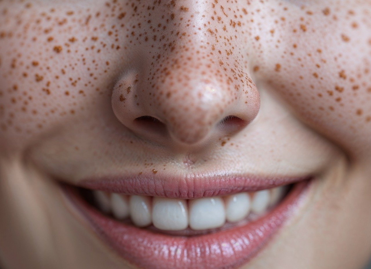 freckles, smile, nose, lips, teeth, skin, close-up, portrait, happy, natural, human, face, clear skin, healthy, cheerful, bright, glowing, warm, soft, detailed, ai generated